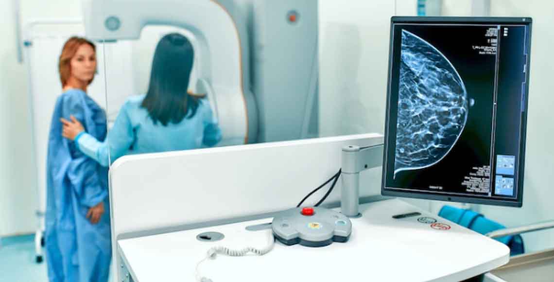Mamografski pregled dojki