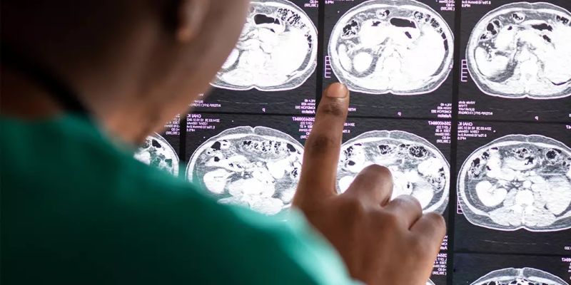 MRI Beograd - Magnetna rezonanca