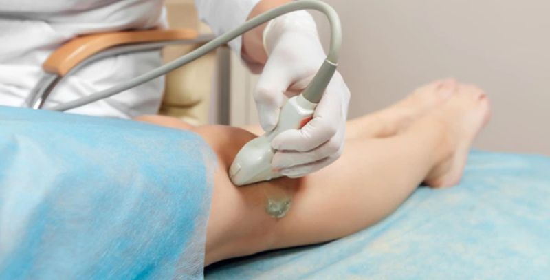 Ultrazvuk mekih tkiva - detaljni pregled