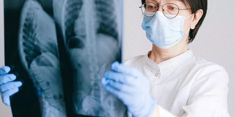 MSCT grudnog koša - rano otkrivanje promena