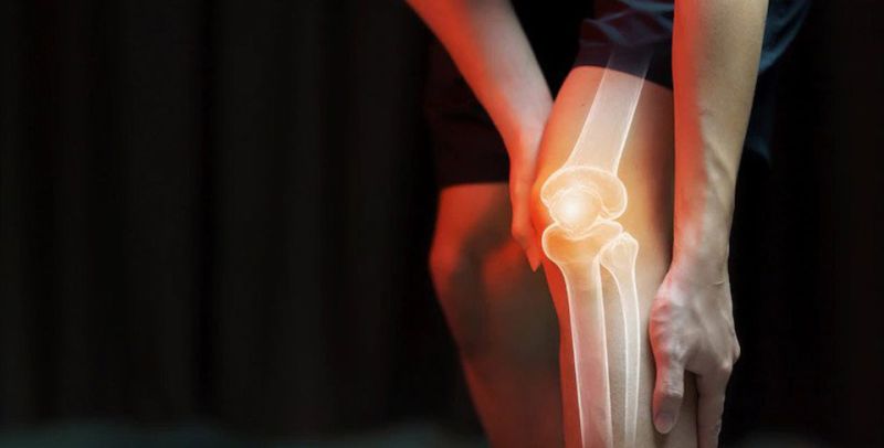 RTG kolena - radiološki pregled