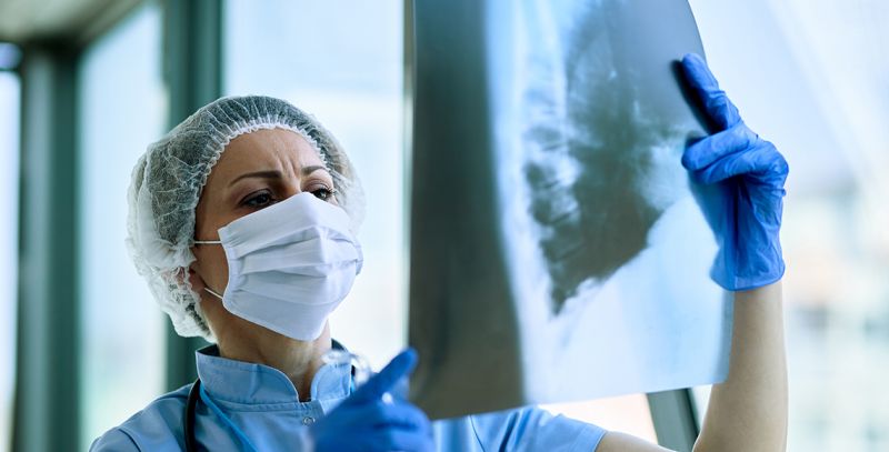 Benigni tumor pluća