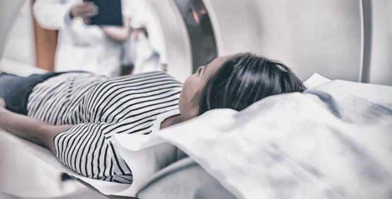 MRI Beograd - Magnetna rezonanca angiografija