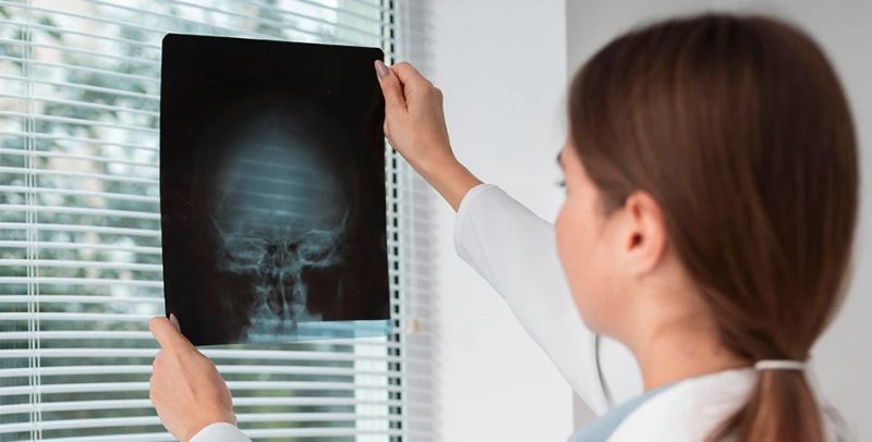 RTG glave - radiološki pregled