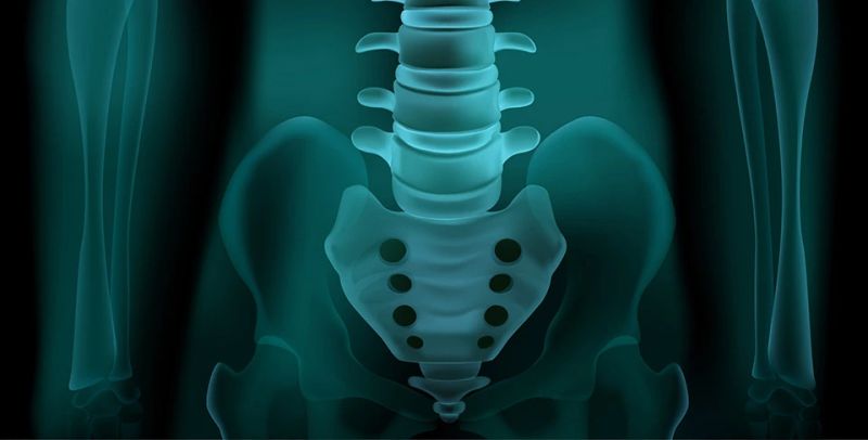 RTG karlice - radiološka dijagnostika