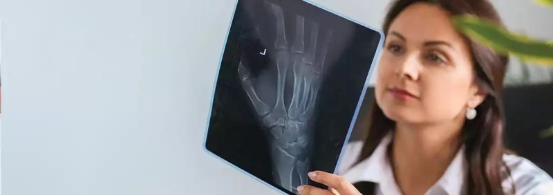 MRI Beograd - Magnetna rezonanca