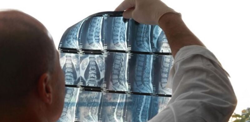 MRI Beograd - Magnetna rezonanca kičme