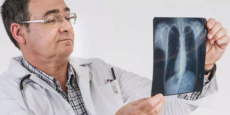 RTG snimanje pluća kod Covid-19