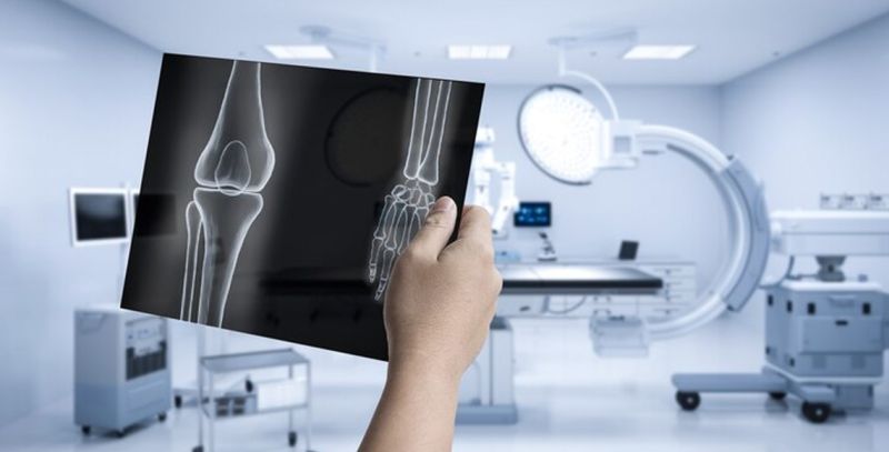 MSCT zglobova - detaljna dijagnostika