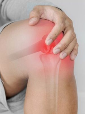 MRI Beograd - Magnetna rezonanca kolena