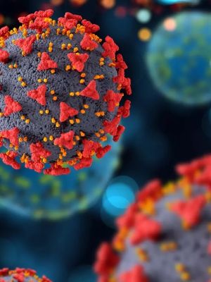 RTG snimanje pluća kod Covid-19