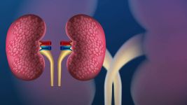 Policistični bubrezi: Simptomi, dijagnoza i lečenje