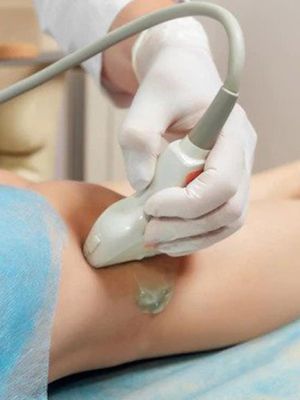 Kolor dopler nogu i ruku