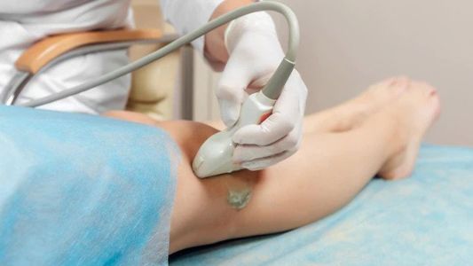 Kolor dopler nogu i ruku