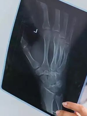 MRI Beograd - Magnetna rezonanca