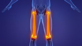 Uzroci i posledice preloma butne kosti