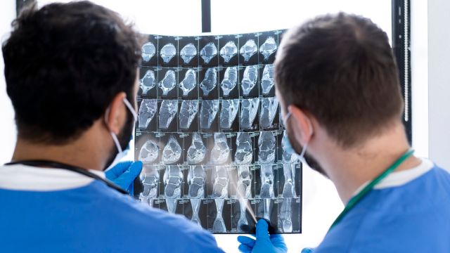 Tumor pleure: Dijagnoza i terapija Tumor pleure: Dijagnoza i terapija