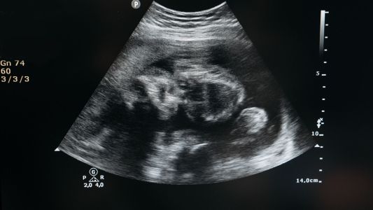 MR i razvoj mozga bebe MR i razvoj mozga bebe