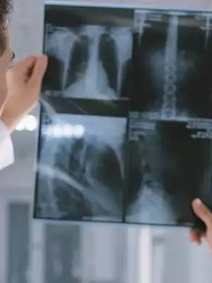 RTG snimanja i dijagnostika