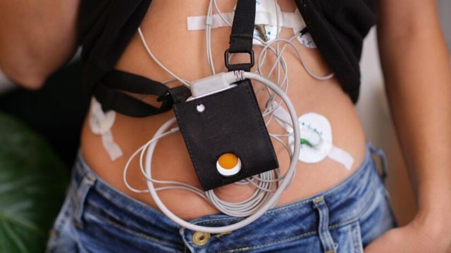 Holter: Šta je i kako funkcioniše? Holter: Šta je i kako funkcioniše?