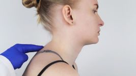 Kifoza: Sve što treba da znate o krivljenju kičme