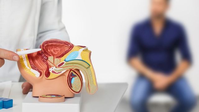 Sarkom prostate: Uzroci, simptomi i tretmani Sarkom prostate: Uzroci, simptomi i tretmani