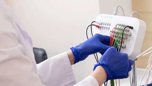 Neurologija Neurologija