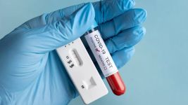 Postcovid sindrom: Dugoročne posledice i oporavak