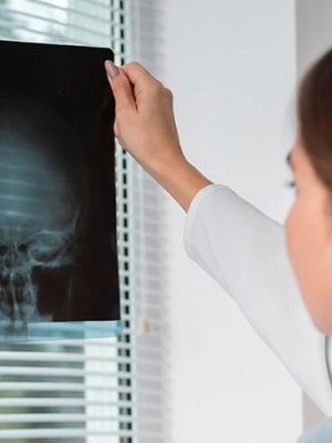 RTG glave - radiološki pregled