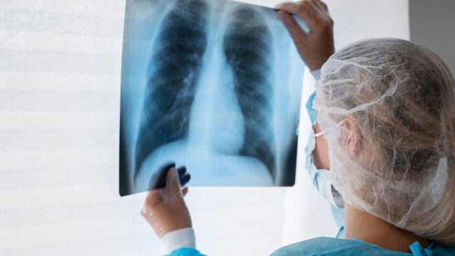 Stenoza plućne arterije: uzroci, simptomi i lečenje