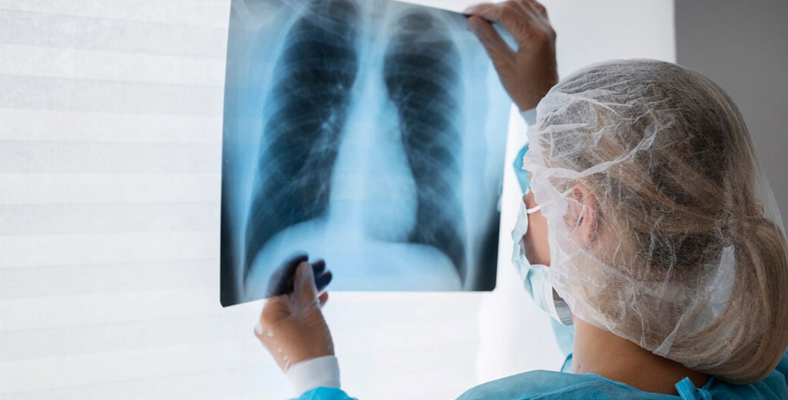 Stenoza plućne arterije