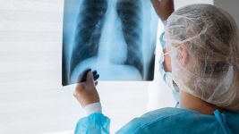 Uzroci i simptomi edema pluća