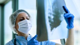 Benigni tumor pluća: Dijagnoza i lečenje