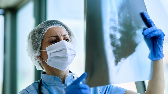 Benigni tumor pluća: Dijagnoza i lečenje Benigni tumor pluća: Dijagnoza i lečenje