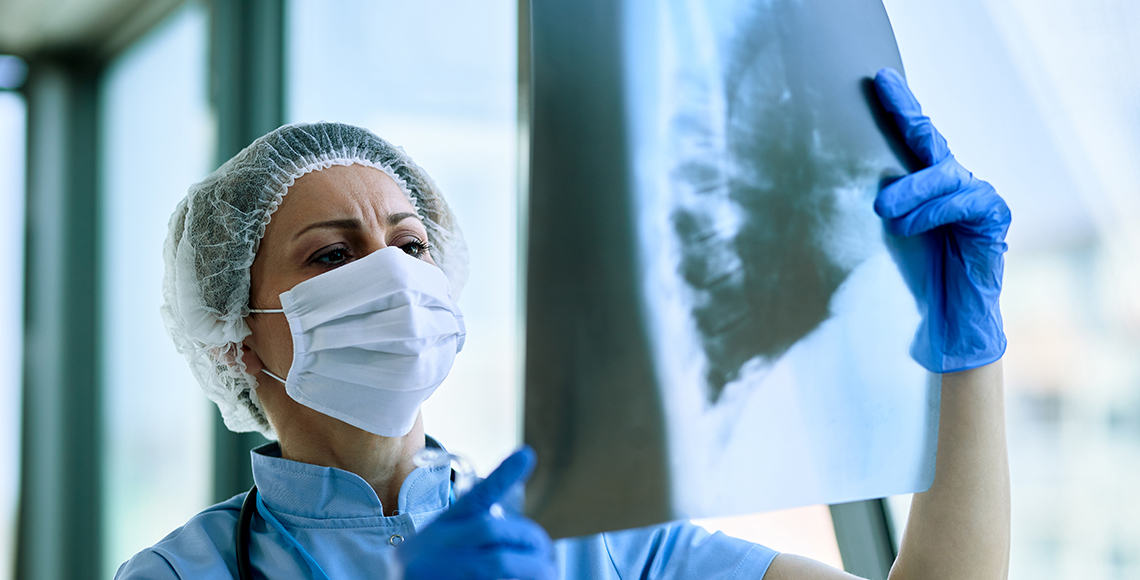 Benigni tumor pluća