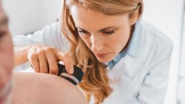 Razumevanje tumora kože: Uzroci, simptomi i prevencija