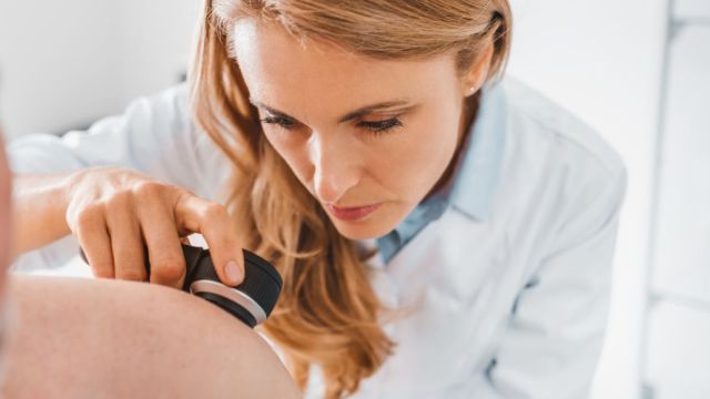 Razumevanje tumora kože: Uzroci, simptomi i prevencija Razumevanje tumora kože: Uzroci, simptomi i prevencija