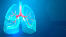 Razumevanje Bronhiektazija: uzroci i simptomi