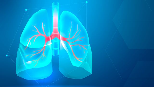 Razumevanje Bronhiektazija: uzroci i simptomi Razumevanje Bronhiektazija: uzroci i simptomi
