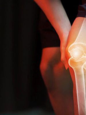 RTG kolena - radiološki pregled