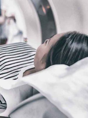 MRI Beograd - Magnetna rezonanca angiografija