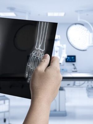 MSCT zglobova - detaljna dijagnostika